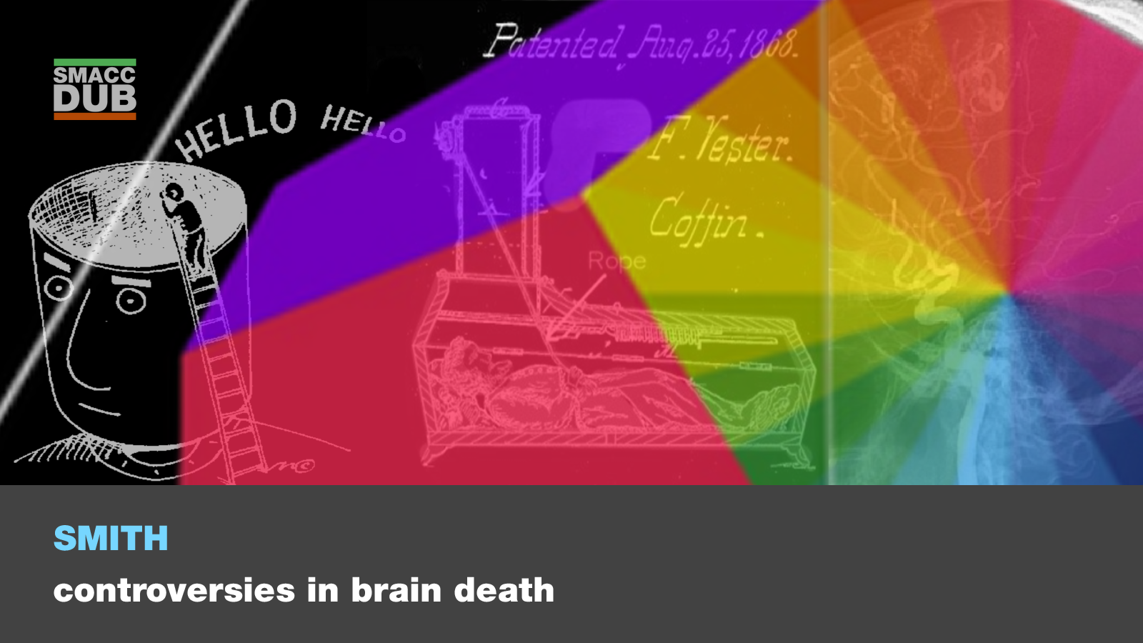 The Controversies in Brain Death: Martin Smith